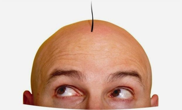 Κάνε το test και μάθε αν θα αποκτήσεις φαλάκρα!!!