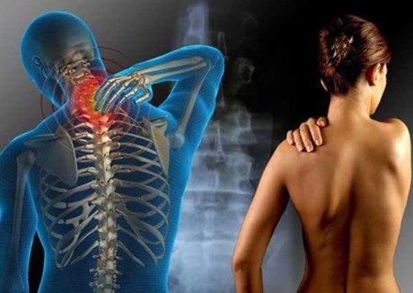 Ινομυαλγία: Διάχυτος πόνος χωρίς… αιτία