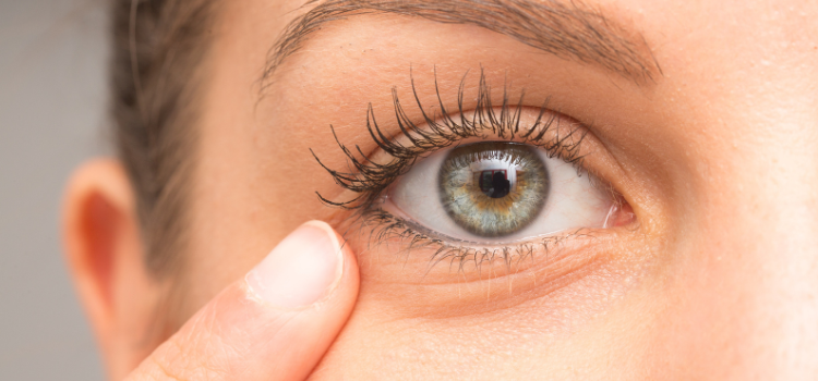 Κριθαράκι στο μάτι: 10 εύκολοι και αποτελεσματικοί τρόποι αντιμετώπισης